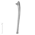 ulna left