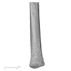 ulna left distal