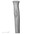 radius left proximal
