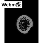 NH MER33 409 Gorilla gorilla ssp. radius left proximal ct stack movie