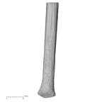 ulna left distal