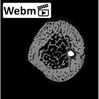 NH MER35 169 Gorilla gorilla ssp. ulna right distal ct stack movie
