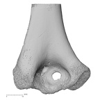 humerus left distal