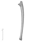 ulna left