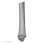 ulna left distal