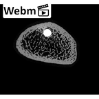 NH MER35 99 Gorilla gorilla gorilla radius left distal ct stack movie