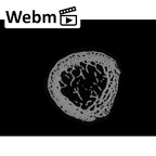NH MER35 99 Gorilla gorilla gorilla radius left proximal ct stack movie