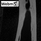 NH MER39 275 Mandrillus leucophaeus hand phalanx second proximal right ct stack movie