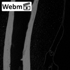 NH MER39 275 Mandrillus leucophaeus hand phalanx third proximal right ct stack movie