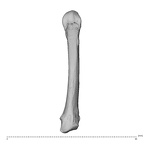 metacarpal fifth right