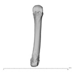 metacarpal fourth right