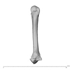 metacarpal second right