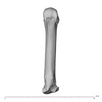 metacarpal third right