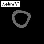 NH ZEN8 9 Mandrillus sphinx metacarpal third left ct stack movie