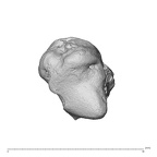 trapezium left
