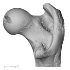 femur right proximal