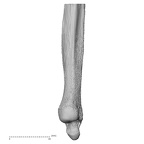 ulna left distal