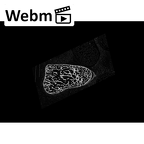 NH CON 214 Pan troglodytes schweinfurthii hamate left ct stack movie