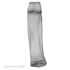hand phalanx fourth proximal left