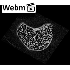 NH CON 214 Pan troglodytes schweinfurthii lunate left ct stack movie
