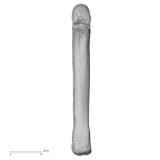 metacarpal fifth left