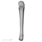metacarpal fourth left