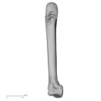 metacarpal second left
