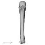 metacarpal third left