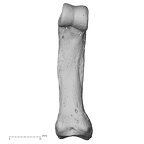hand phalanx fifth proximal left