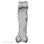 hand phalanx second proximal left