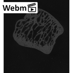 NH MER00 279 Pan troglodytes troglodytes lunate left ct stack movie