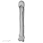 metacarpal fifth left