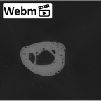 NH MER00 279 Pan troglodytes troglodytes metacarpal first left ct stack movie