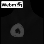 NH MER00 279 Pan troglodytes troglodytes metacarpal second left ct stack movie