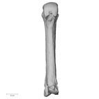 metacarpal third left