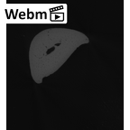 NH MER32 401 Pan troglodytes troglodytes hand phalanx second proximal left ct stack movie