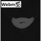 NH MER32 401 Pan troglodytes troglodytes hand phalanx third middle left ct stack movie