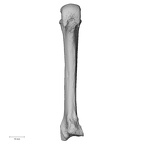metacarpal third left
