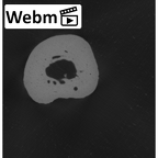 NH MER33 440 Pan troglodytes ellioti metacarpal first right ct stack movie