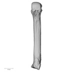 metacarpal fourth right