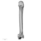 metacarpal second right