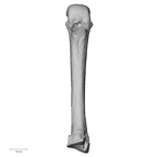 metacarpal third right