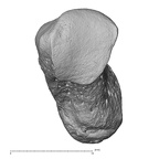 pisiform right