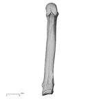 metacarpal fifth right