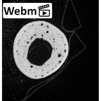 NH MER33 719 Pan troglodytes schweinfurthii hand phalanx first proximal right ct stack movie