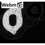 NH MER33 719 Pan troglodytes schweinfurthii hand phalanx fourth proximal right ct stack movie