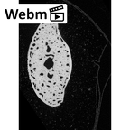 NH MER33 719 Pan troglodytes schweinfurthii hand phalanx second middle right ct stack movie