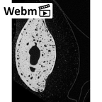 NH MER33 719 Pan troglodytes schweinfurthii hand phalanx third middle right ct stack movie