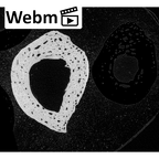 NH MER33 719 Pan troglodytes schweinfurthii hand phalanx third proximal right ct stack movie