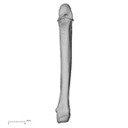 metacarpal fifth right